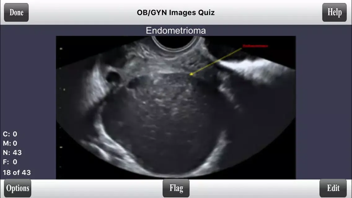 ARDMS OBGYN Ultrasound Flashcards for ARDMS OB/GYN Board Review スクリーンショット
