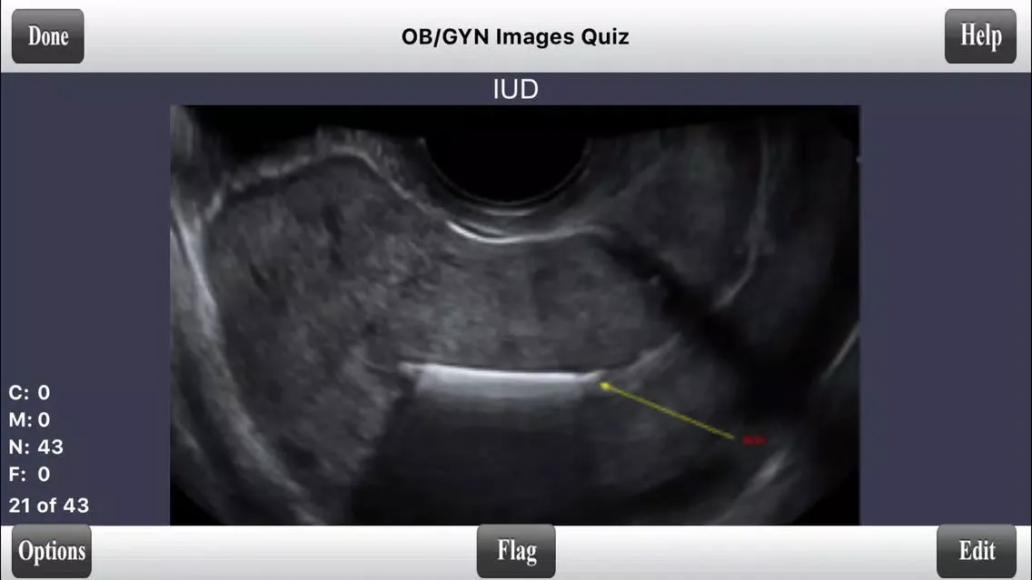 ARDMS OBGYN Ultrasound Flashcards for ARDMS OB/GYN Board Review スクリーンショット
