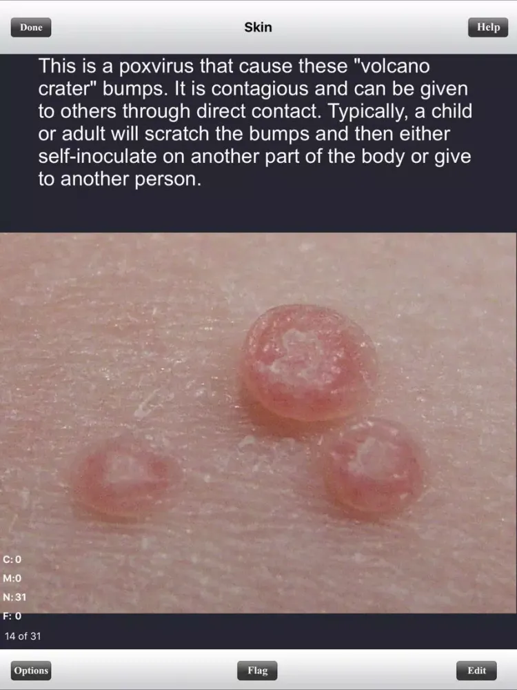 USMLE Step 1 Pathology Flashcards Lite iPad  스크린샷