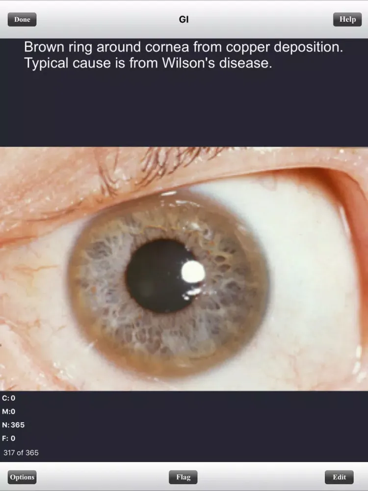 USMLE Step 1 Pathology Flashcards Lite iPad  스크린샷