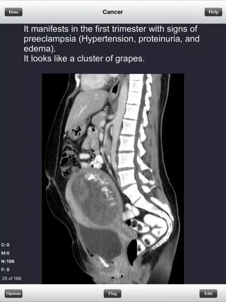 USMLE Step 1 Pathology Flashcards Lite iPad  스크린샷