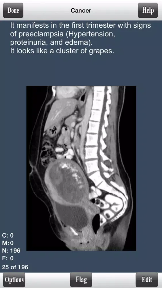 USMLE Step 1 Pathology Flashcards Lite 스크린샷