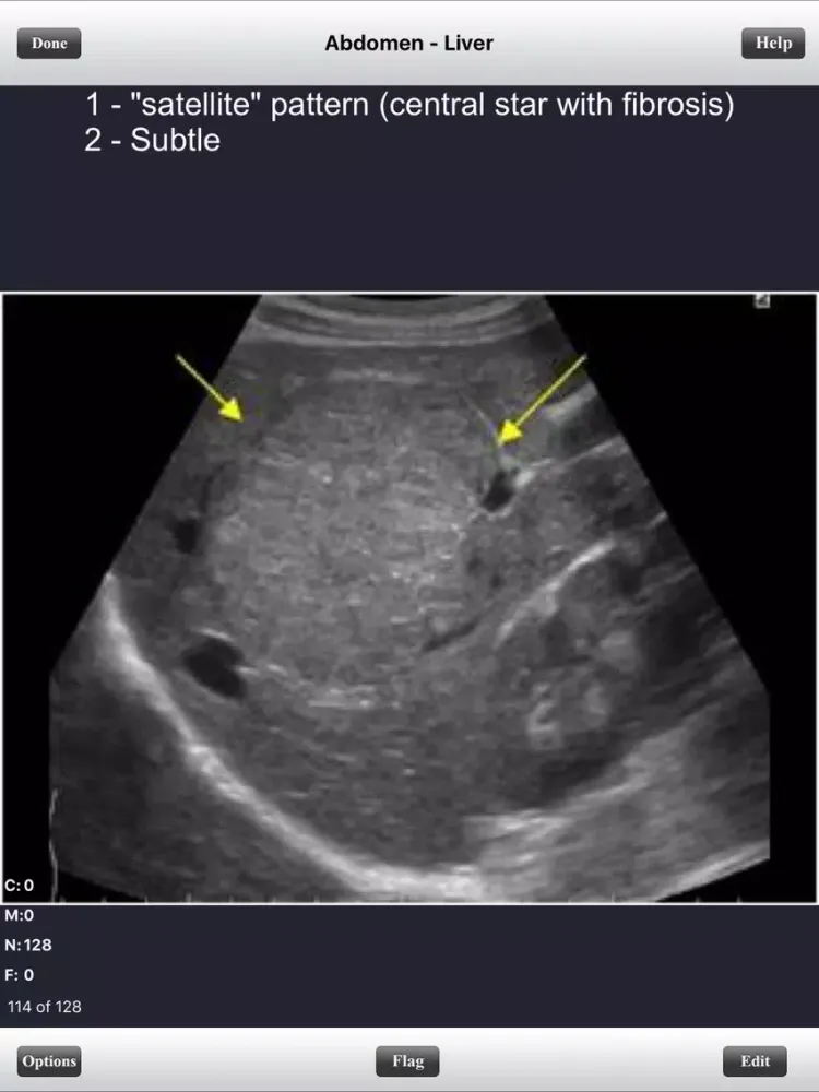 Captures d'écran de ARDMS Ultrasound Flashcards Board Review Lite iPad 