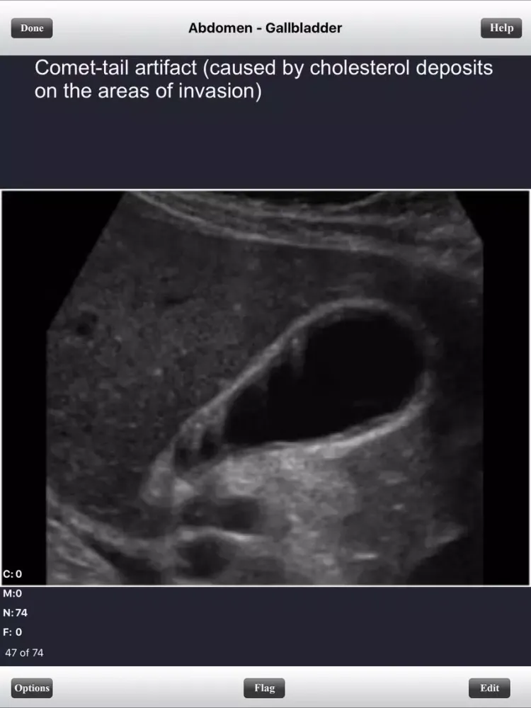 Captures d'écran de ARDMS Ultrasound Flashcards Board Review Lite iPad 