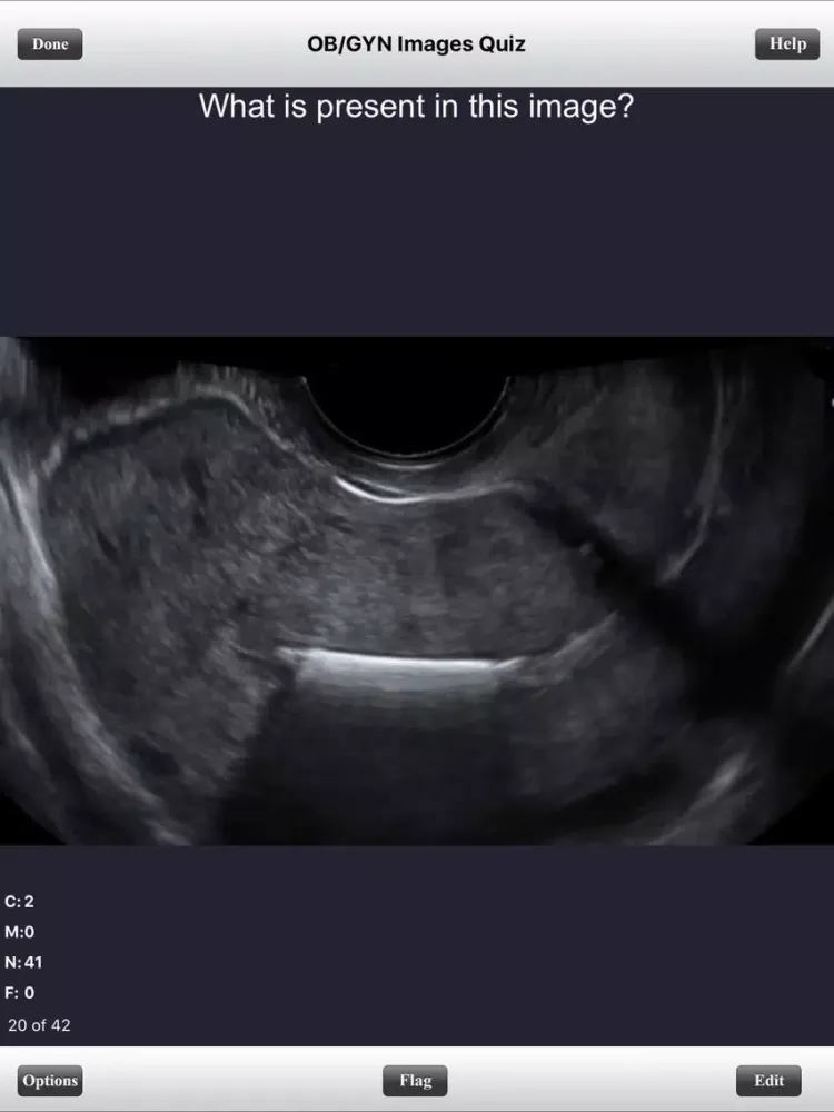 Captures d'écran de ARDMS Ultrasound Flashcards Board Review Lite iPad 