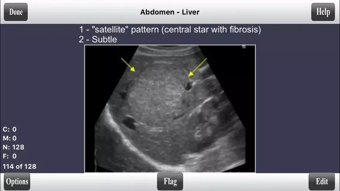 Captures d'écran de ARDMS Ultrasound Flashcards Board Review Lite