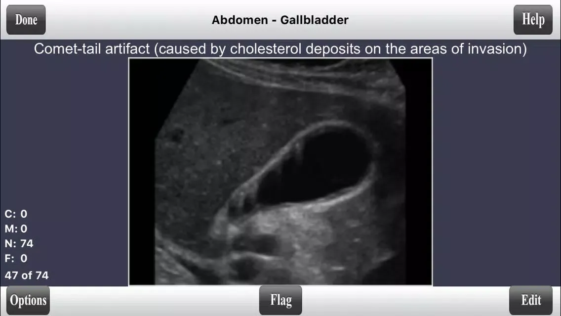 Captures d'écran de ARDMS Ultrasound Flashcards Board Review Lite