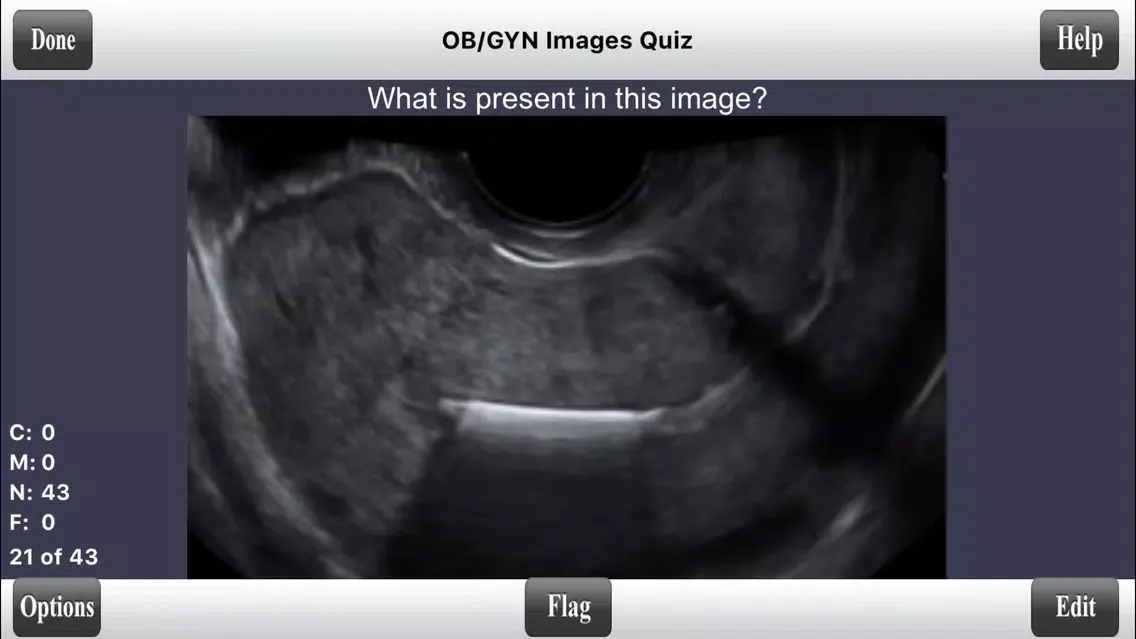 Captures d'écran de ARDMS Ultrasound Flashcards Board Review Lite