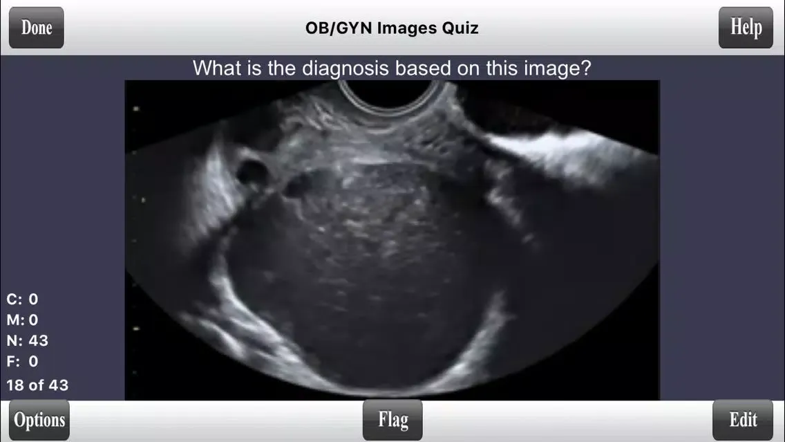 Captures d'écran de ARDMS Ultrasound Flashcards Board Review Lite