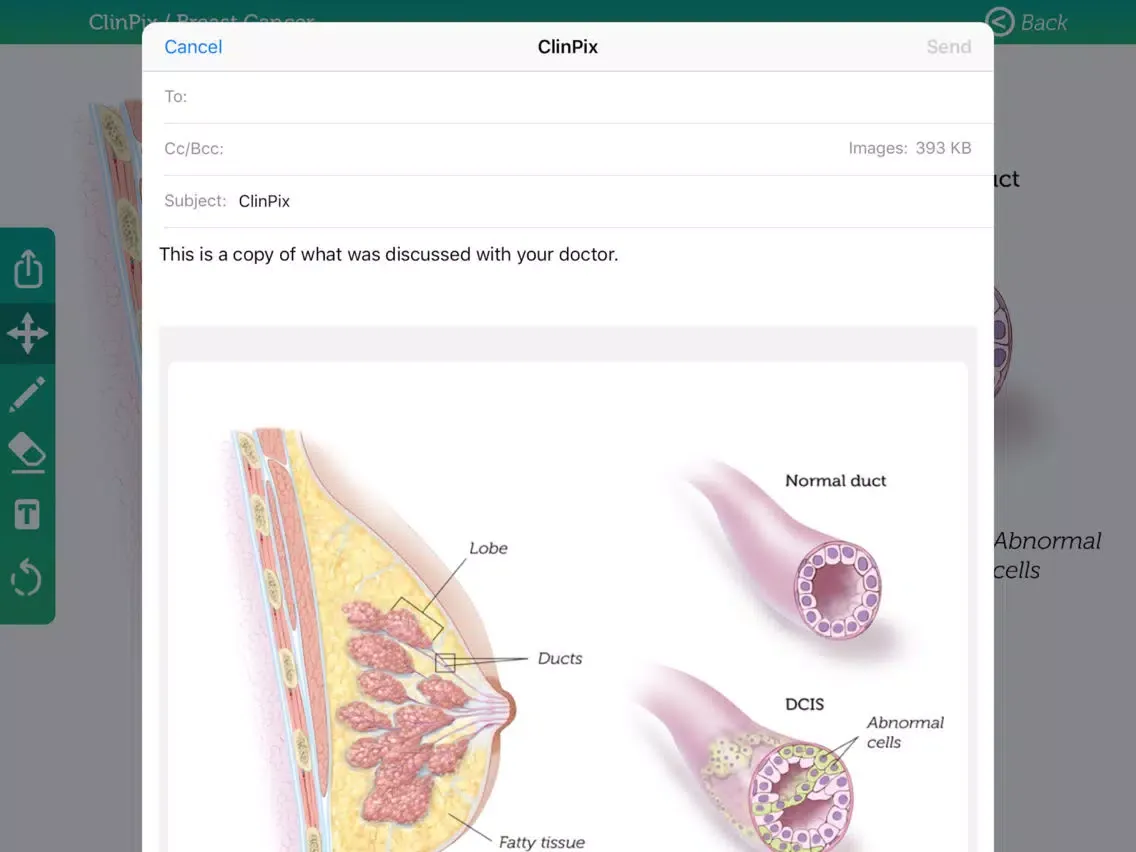 ClinPix: Breast Cancer iPad 应用截图