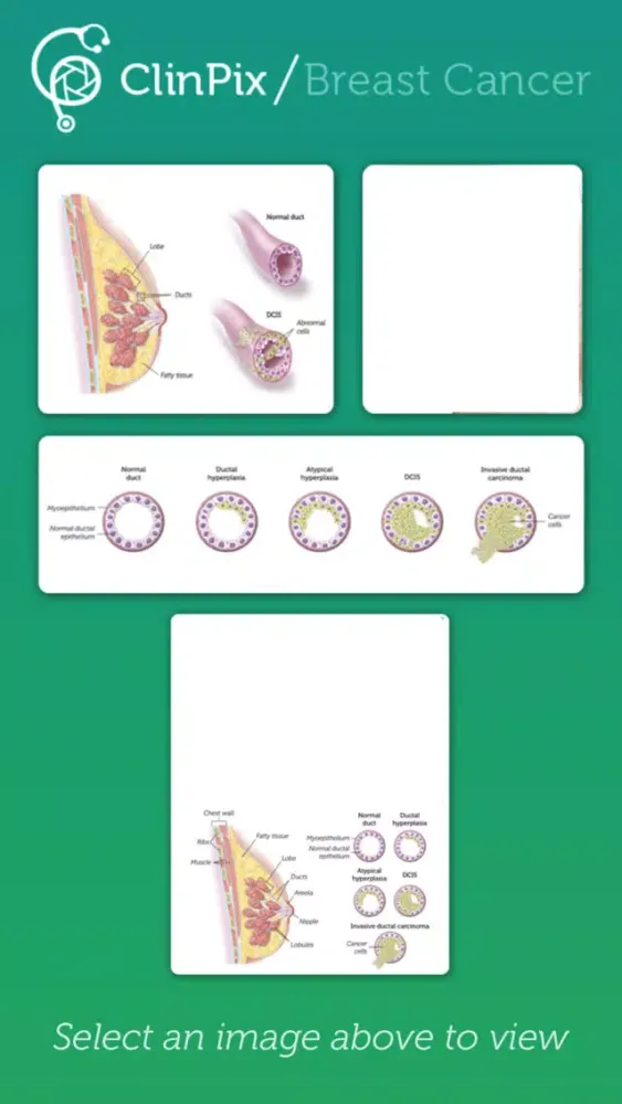 ClinPix: Breast Cancer应用截图