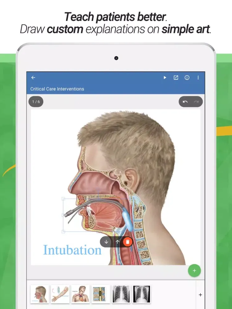 صور drawMD® - Patient Education iPad 