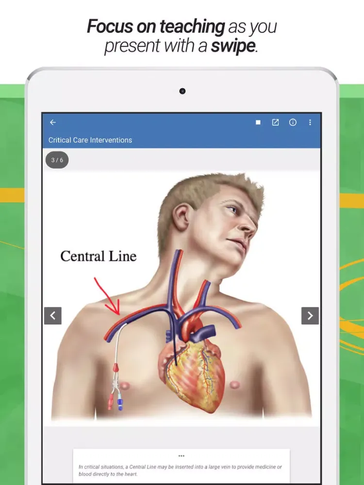 صور drawMD® - Patient Education iPad 