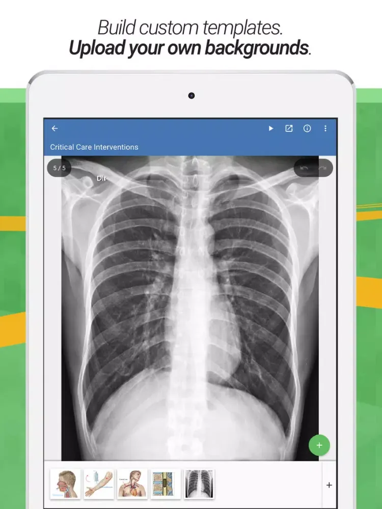 صور drawMD® - Patient Education iPad 