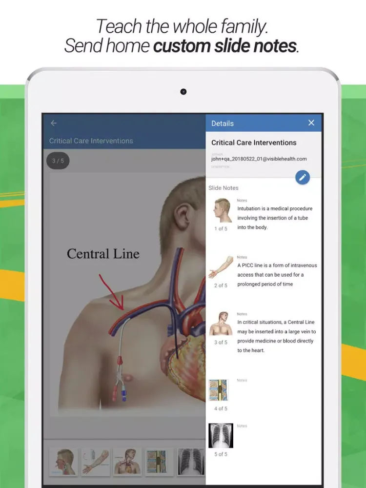 صور drawMD® - Patient Education iPad 