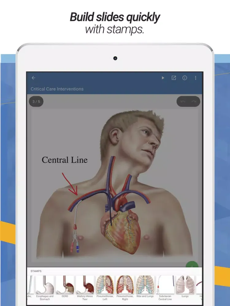 صور drawMD® - Patient Education iPad 