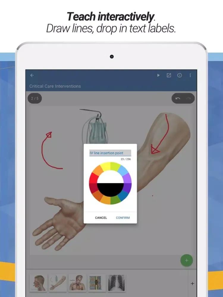 صور drawMD® - Patient Education iPad 