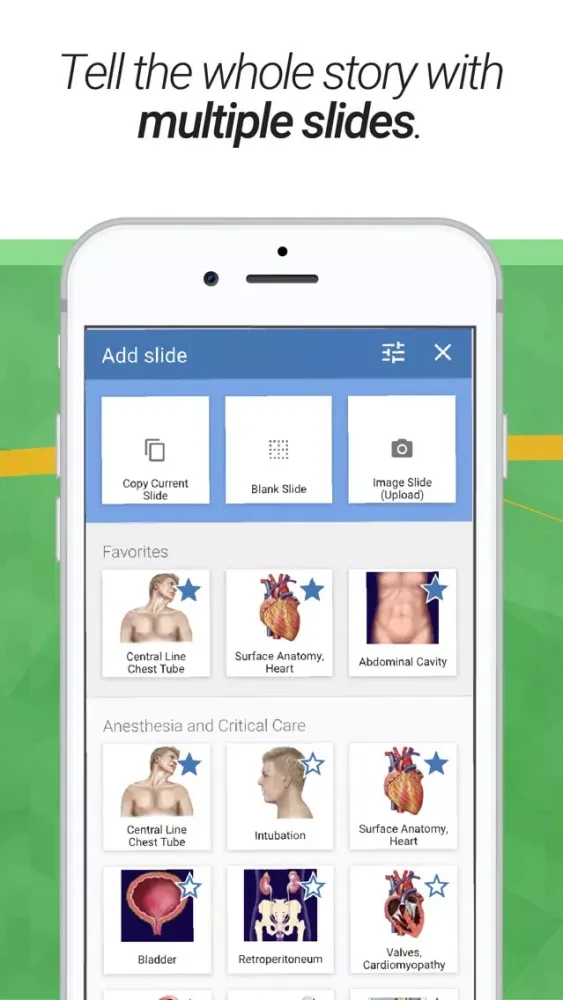 صور drawMD® - Patient Education