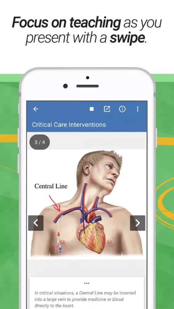 صور drawMD® - Patient Education