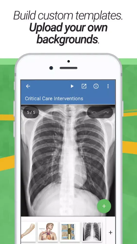 صور drawMD® - Patient Education