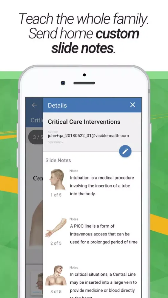 صور drawMD® - Patient Education