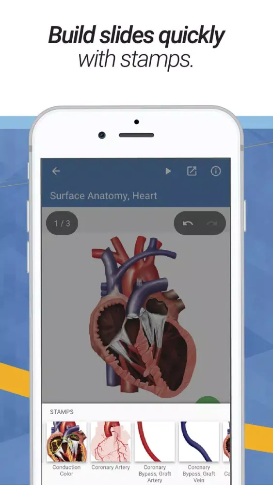 صور drawMD® - Patient Education