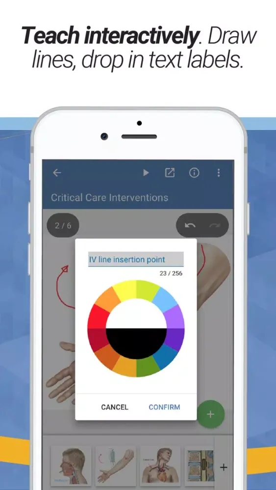 صور drawMD® - Patient Education