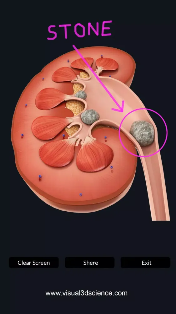 ภาพหน้าจอของ My Urinary System