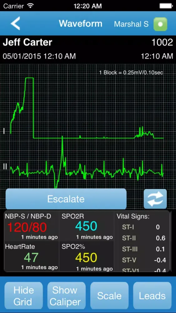 Capturas de pantalla de Vocera Alarm Management