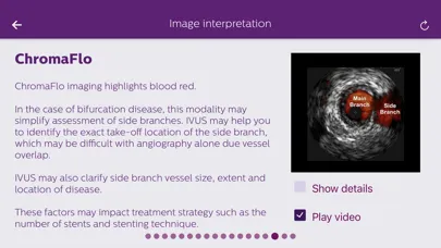 Capturas de tela do Philips Coronary IVUS Tutor