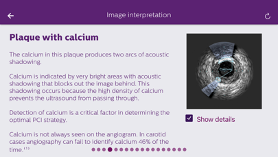 Philips Coronary IVUS Tutor应用截图