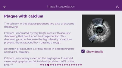 Capturas de tela do Philips Coronary IVUS Tutor