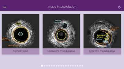 Philips Coronary IVUS Tutor应用截图