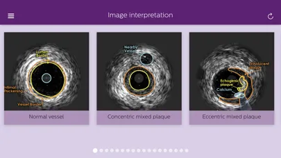 Capturas de tela do Philips Coronary IVUS Tutor