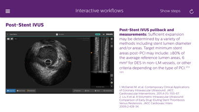 Philips Coronary IVUS Tutor应用截图