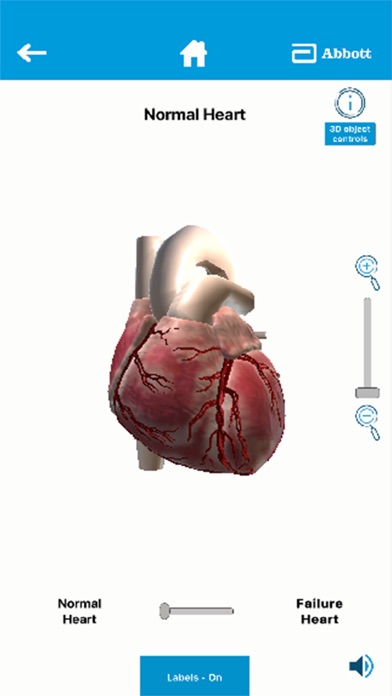LVAD by Abbott应用截图