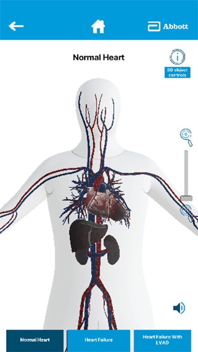 LVAD by Abbott应用截图
