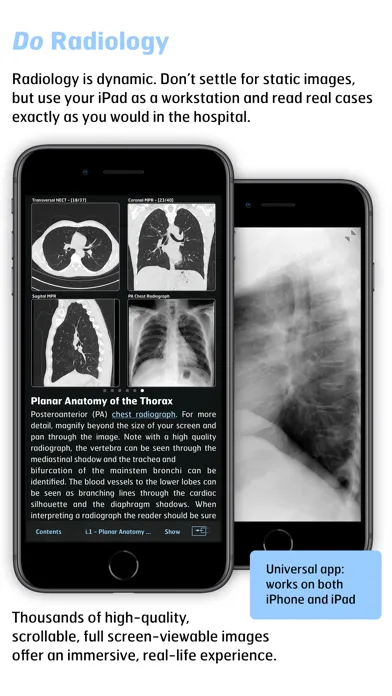 Radiology - Thoracic Imaging سکرین شاٹس