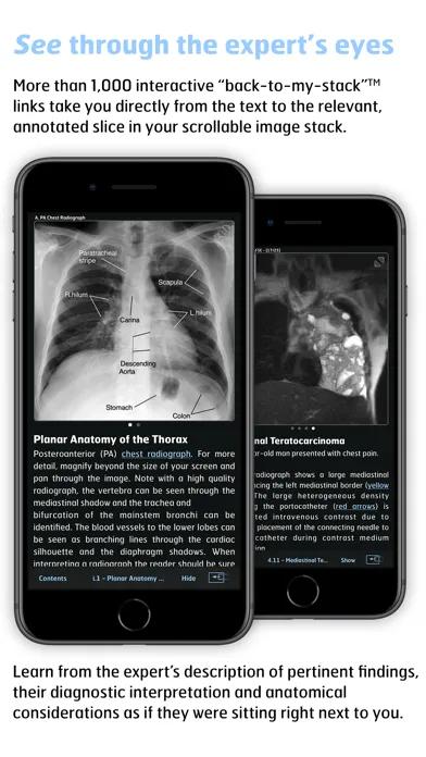 Radiology - Thoracic Imaging سکرین شاٹس