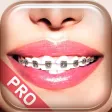 Braces Photo Booth Pro Braces Photo Booth Pro