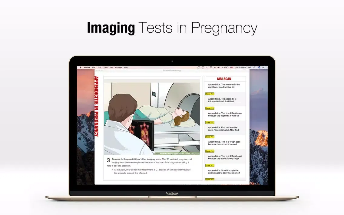 Tangkapan skrin Appendicitis Radiology
