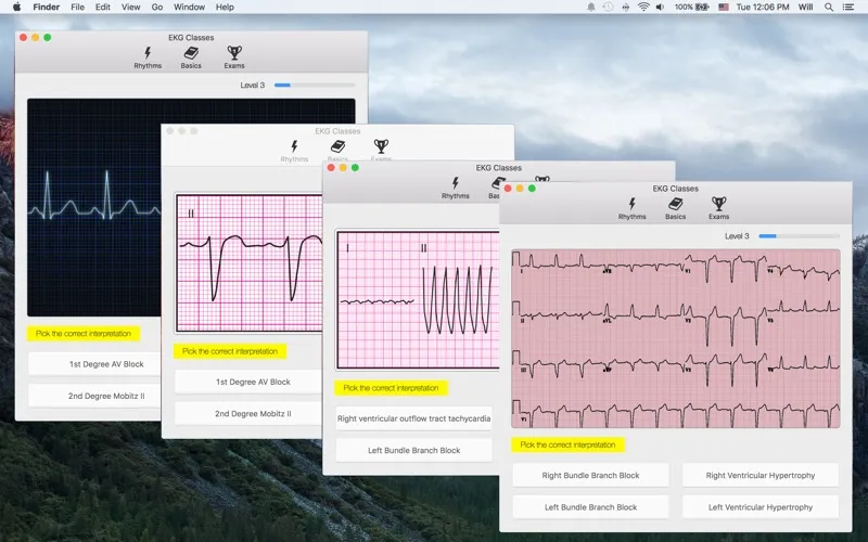 Tangkapan layar EKG Classes