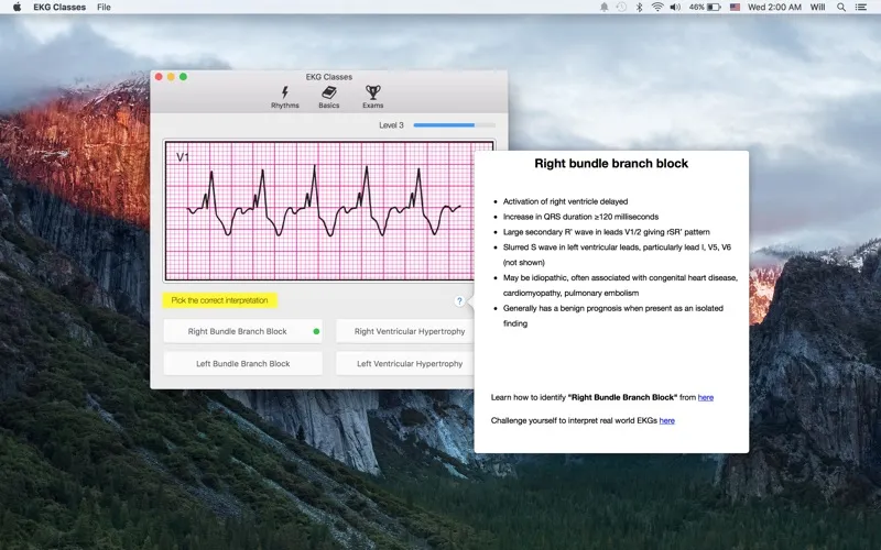 Tangkapan layar EKG Classes