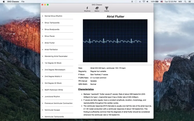Tangkapan layar EKG Classes