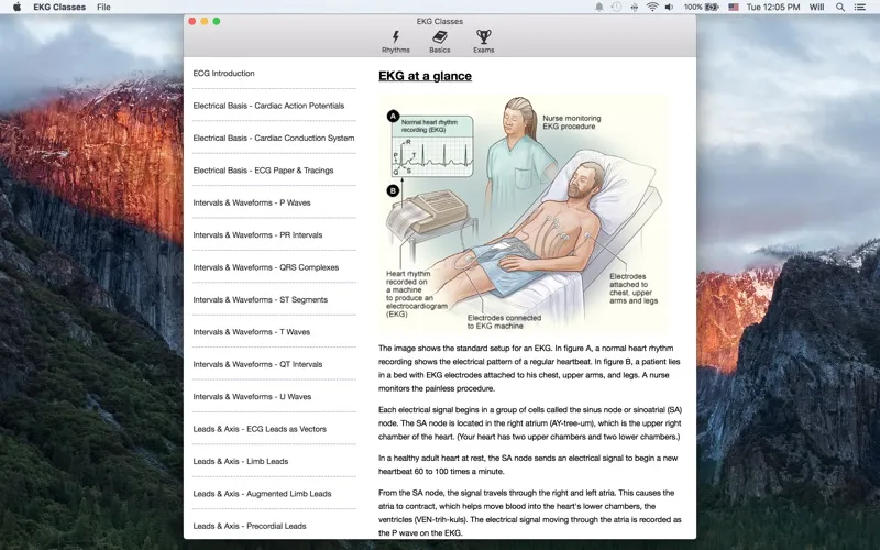 Tangkapan layar EKG Classes