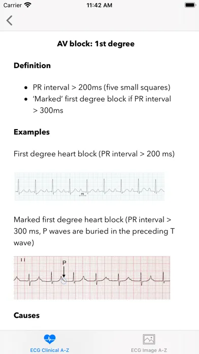 ECG A-Z Pro 스크린샷