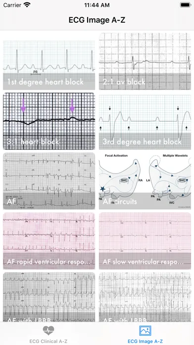 ECG A-Z Pro 스크린샷