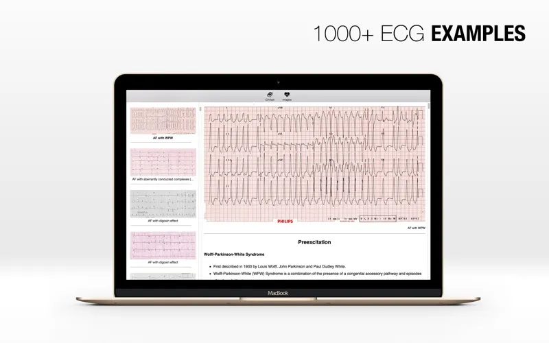 ECG A-Z Screenshots