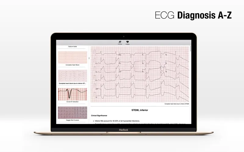 ECG A-Z Screenshots