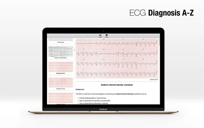 ECG A-Z Screenshots
